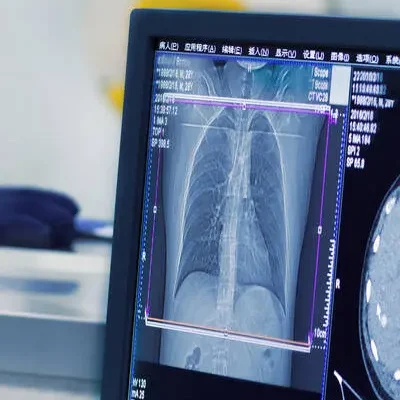 xray of chest in a medical setting